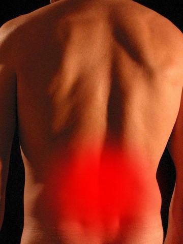 Fisioterapia