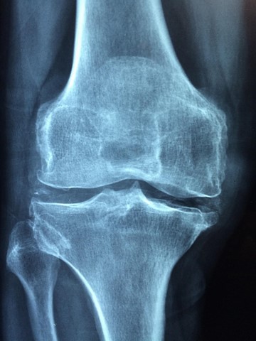 Fisioterapia muscoesqueletica